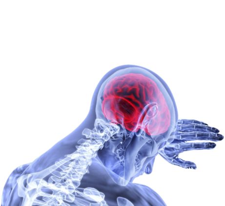 Alzheimer v mozku po dýchání kovového prachu